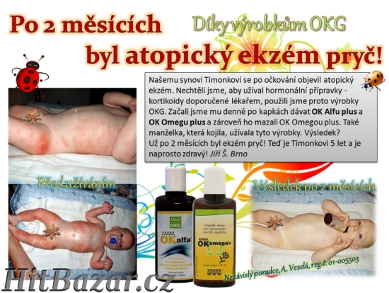 Přírodní bylinné výrobky na atopický ekzém Alfa + Omega+