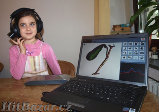 Prodám diagnostický přístroj Oberon